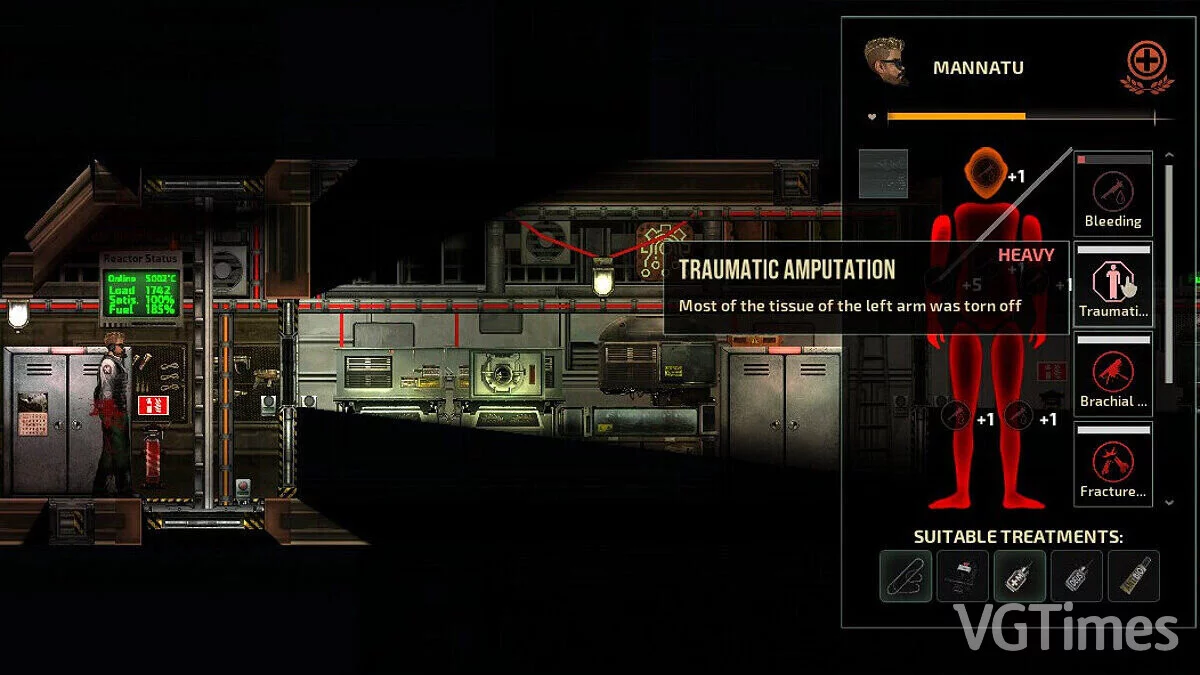 Barotrauma — Нейротравма