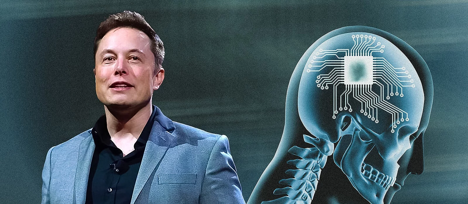 Elon Musk Anuncia la Exitosa Implantación del Tercer Chip de Neuralink