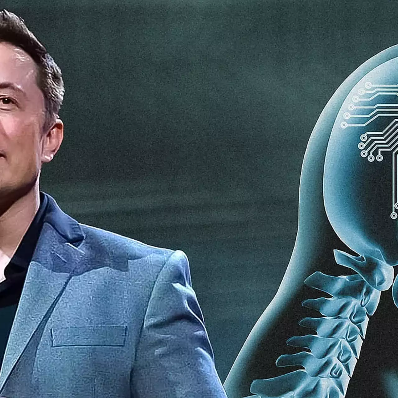 Маск повідомив про вживлення третього імпланта Neuralink у мозок людини