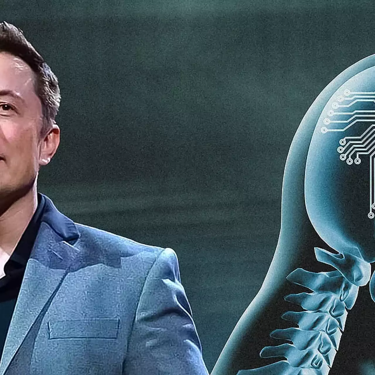 Elon Musk Mengumumkan Keberhasilan Penanaman Chip Neuralink Ketiga